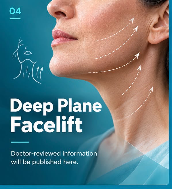 Deep Plane Facelift